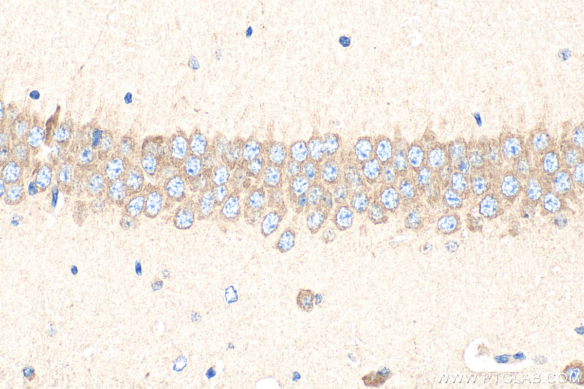 Immunohistochemistry (IHC) staining of mouse brain tissue using FMR1 Polyclonal antibody (13755-1-AP)