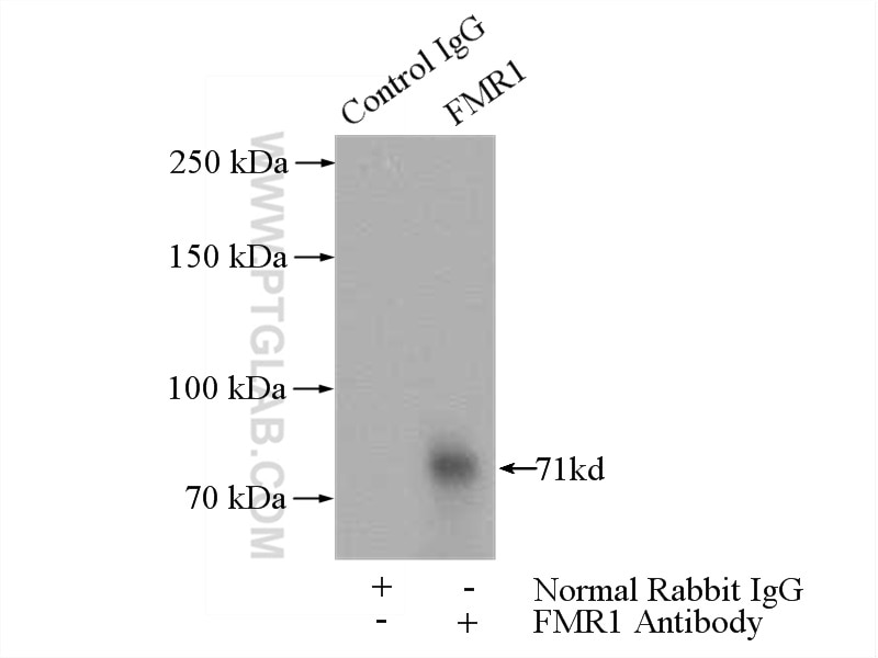 Immunoprecipitation (IP) experiment of HeLa cells using FMR1 Polyclonal antibody (13755-1-AP)