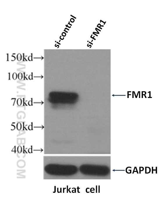 Western Blot (WB) analysis of Jurkat cells using FMR1 Polyclonal antibody (13755-1-AP)