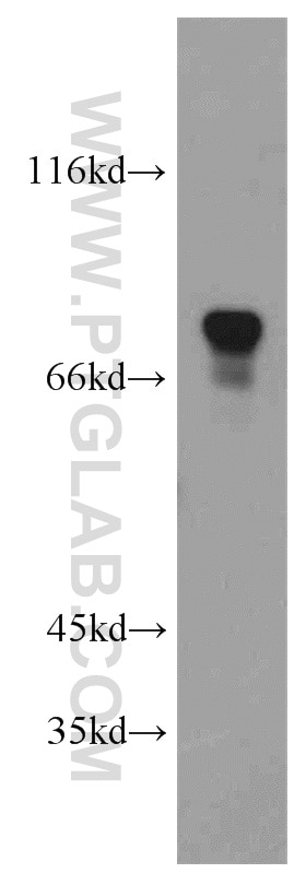 Western Blot (WB) analysis of HeLa cells using FMR1 Polyclonal antibody (13755-1-AP)