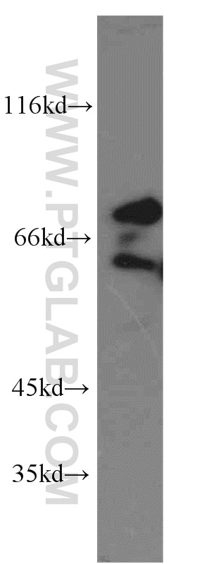 Western Blot (WB) analysis of K-562 cells using FMR1 Polyclonal antibody (13755-1-AP)