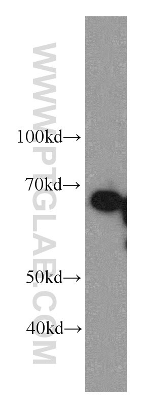 Western Blot (WB) analysis of mouse brain tissue using FMR1 Polyclonal antibody (13755-1-AP)