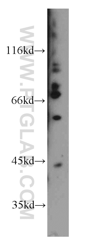 Western Blot (WB) analysis of mouse thymus tissue using FMR1 Polyclonal antibody (13755-1-AP)