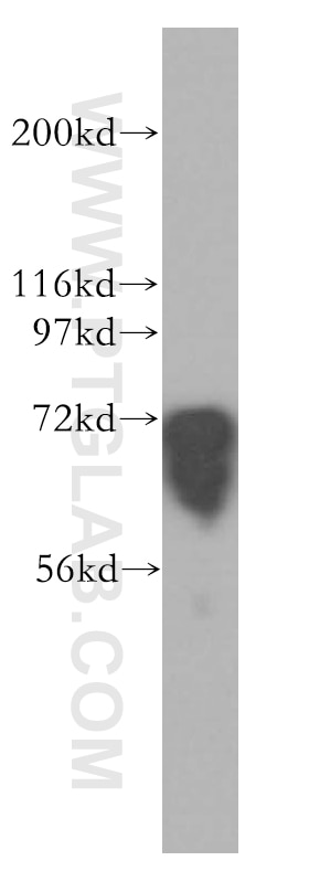 Western Blot (WB) analysis of Jurkat cells using FMR1 Polyclonal antibody (13755-1-AP)