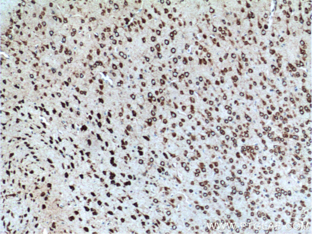 Immunohistochemistry (IHC) staining of mouse brain tissue using FMR1 Monoclonal antibody (66548-1-Ig)