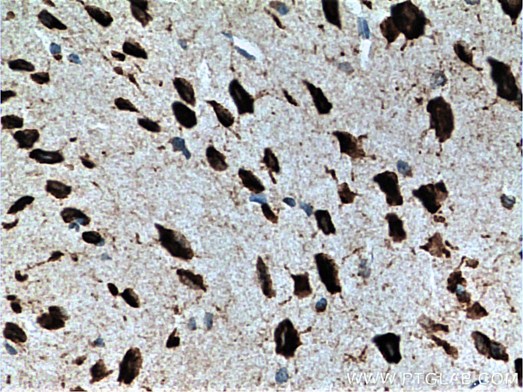 Immunohistochemistry (IHC) staining of mouse brain tissue using FMR1 Monoclonal antibody (66548-1-Ig)