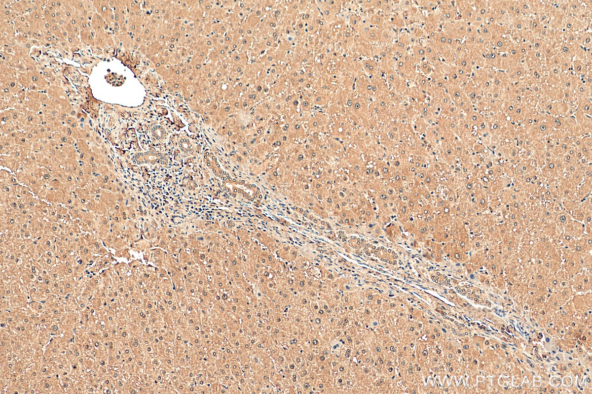 IHC staining of human liver using 66548-1-Ig