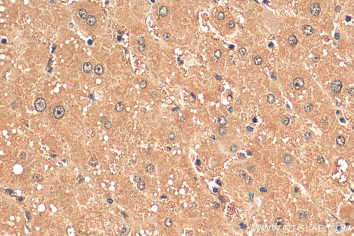 Immunohistochemistry (IHC) staining of human liver tissue using FMR1 Monoclonal antibody (66548-1-Ig)