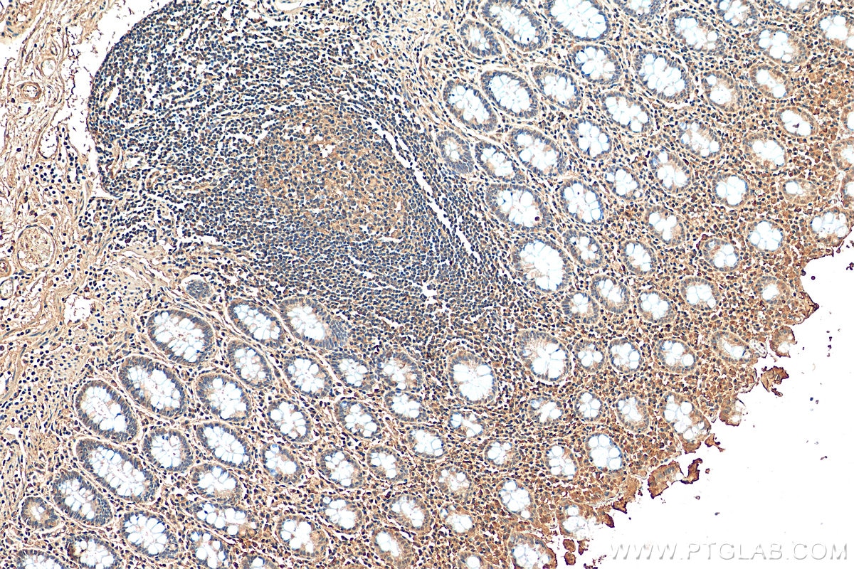 Immunohistochemistry (IHC) staining of human colon tissue using FMR1 Monoclonal antibody (66548-1-Ig)