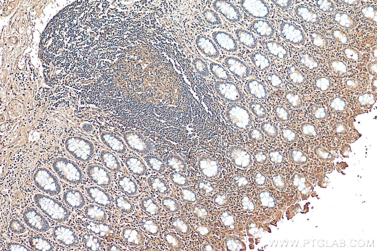 IHC staining of human colon using 66548-1-Ig