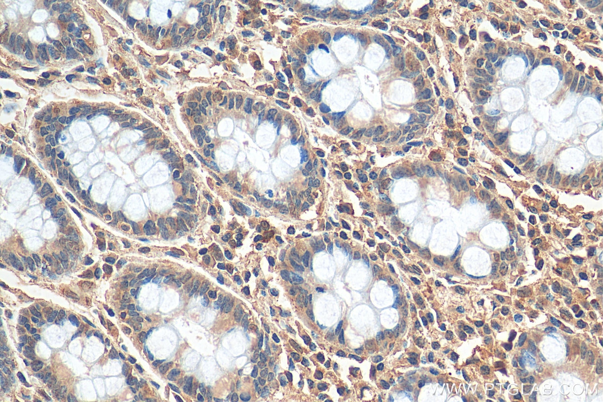 Immunohistochemistry (IHC) staining of human colon tissue using FMR1 Monoclonal antibody (66548-1-Ig)