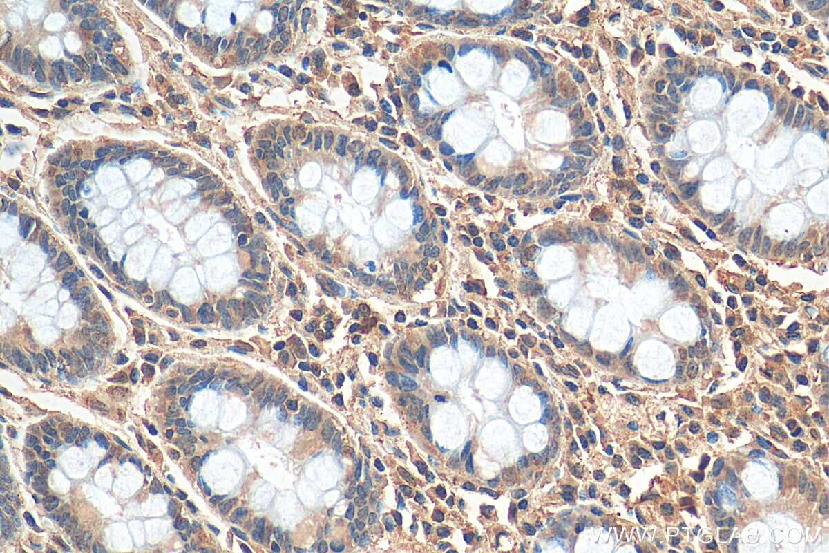 IHC staining of human colon using 66548-1-Ig