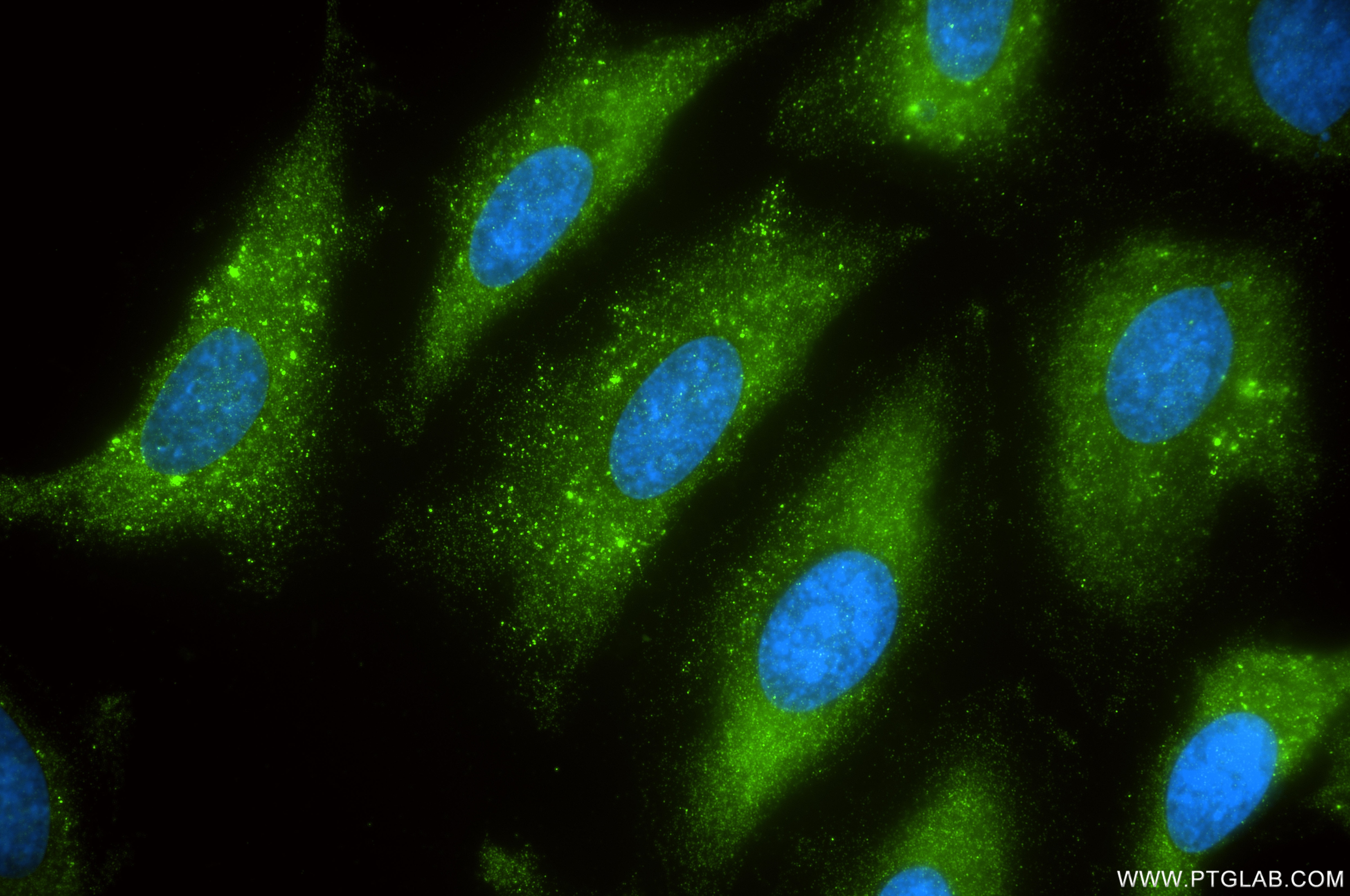 IF Staining of HeLa using 87803-1-RR Immunofluorescence (IF) / fluorescent staining of HeLa cells using FMR1 Recombinant monoclonal antibody (87803-1-RR)