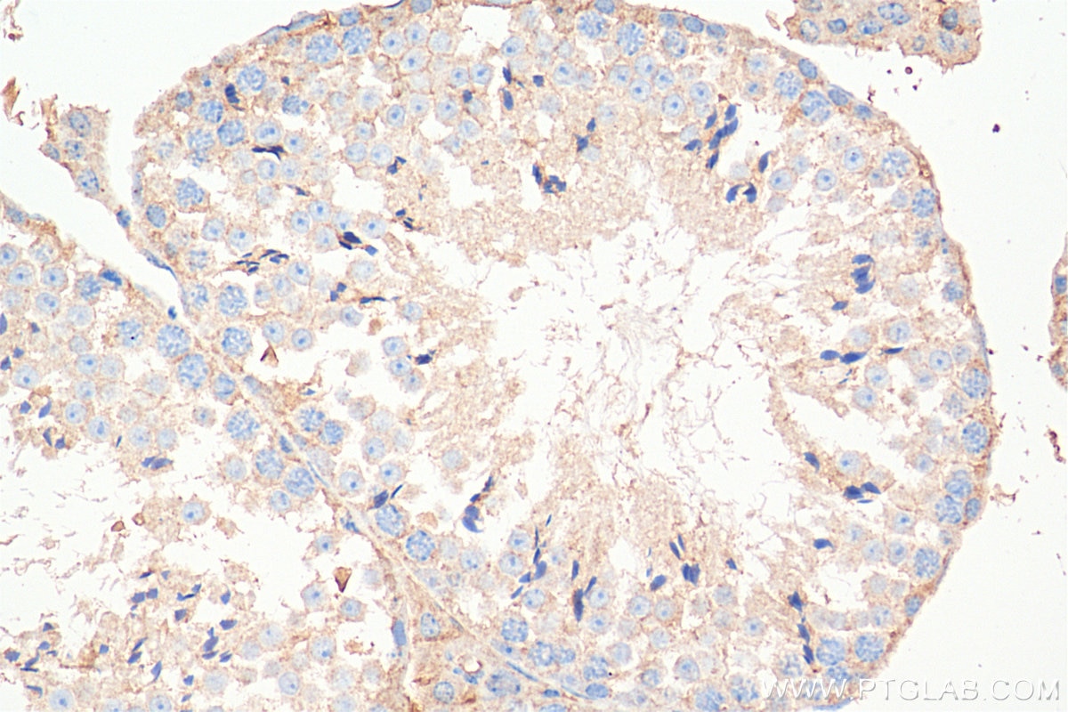 Immunohistochemistry (IHC) staining of mouse testis tissue using FMR1NB Polyclonal antibody (11069-2-AP)