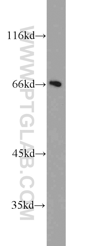 Western Blot (WB) analysis of A549 cells using FMR1NB Polyclonal antibody (11069-2-AP)