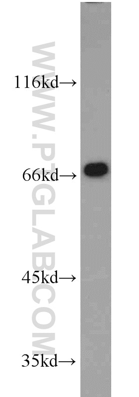 Western Blot (WB) analysis of MCF-7 cells using FMR1NB Polyclonal antibody (11069-2-AP)