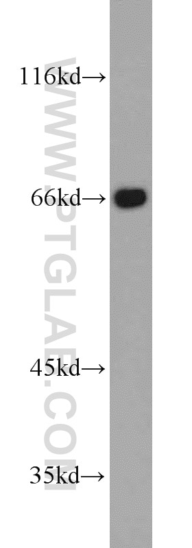 Western Blot (WB) analysis of SKOV-3 cells using FMR1NB Polyclonal antibody (11069-2-AP)