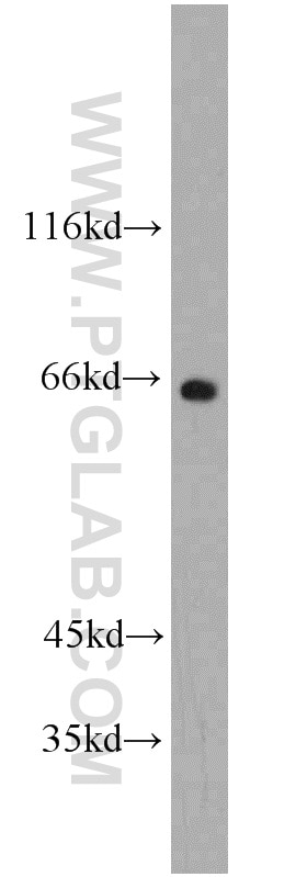 Western Blot (WB) analysis of MCF-7 cells using FMR1NB Polyclonal antibody (11069-2-AP)