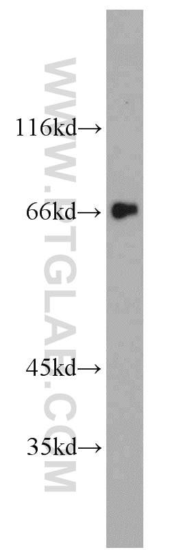 Western Blot (WB) analysis of SKOV-3 cells using FMR1NB Polyclonal antibody (11069-2-AP)