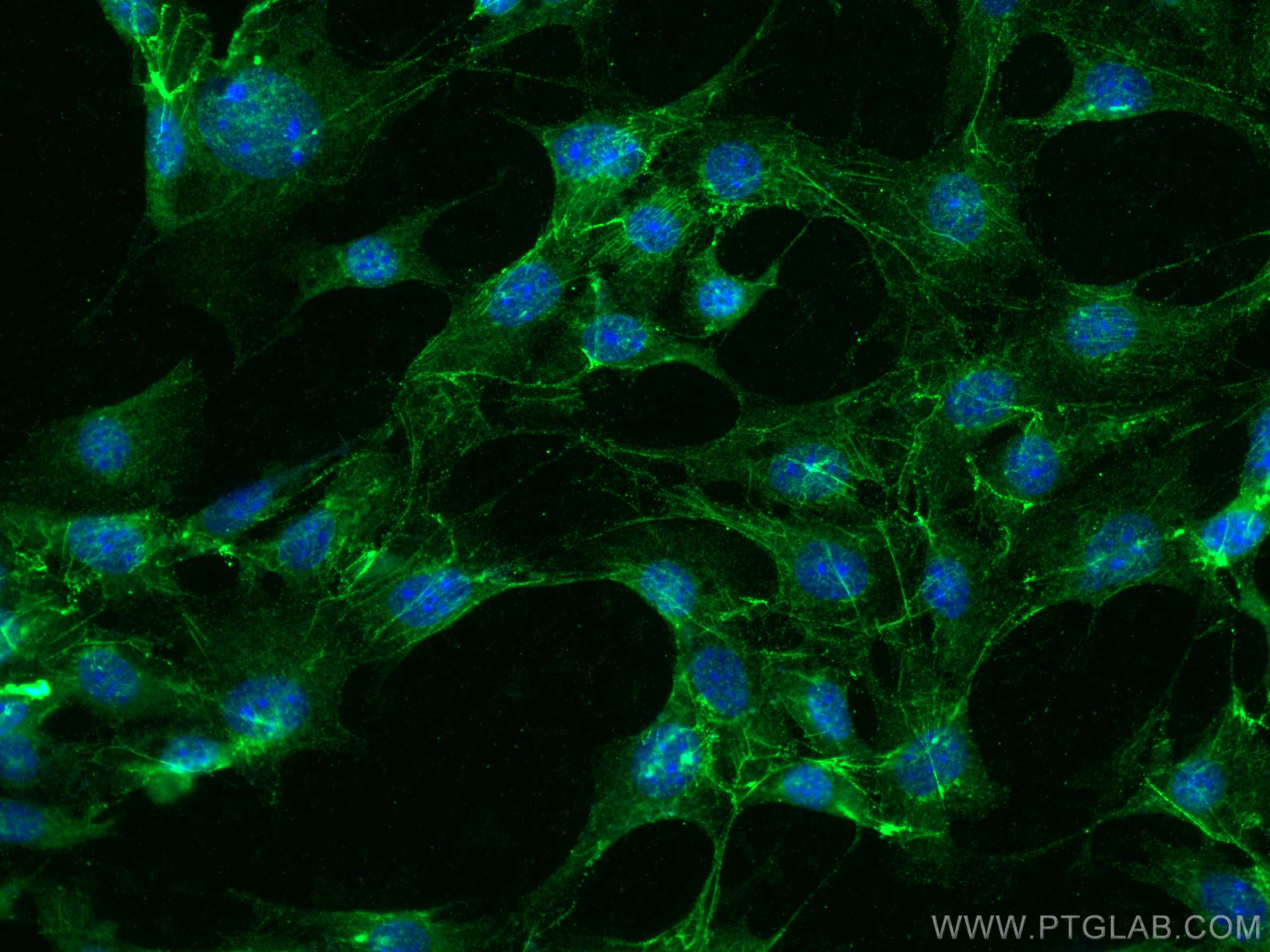 Immunofluorescence (IF) / fluorescent staining of NIH/3T3 cells using Fibronectin Polyclonal antibody (15613-1-AP)