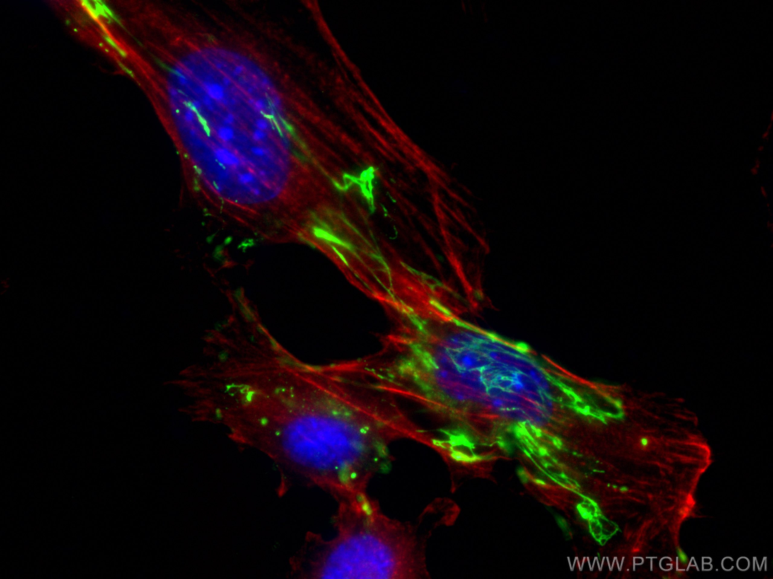 Immunofluorescence (IF) / fluorescent staining of NIH/3T3 cells using Fibronectin Polyclonal antibody (15613-1-AP)