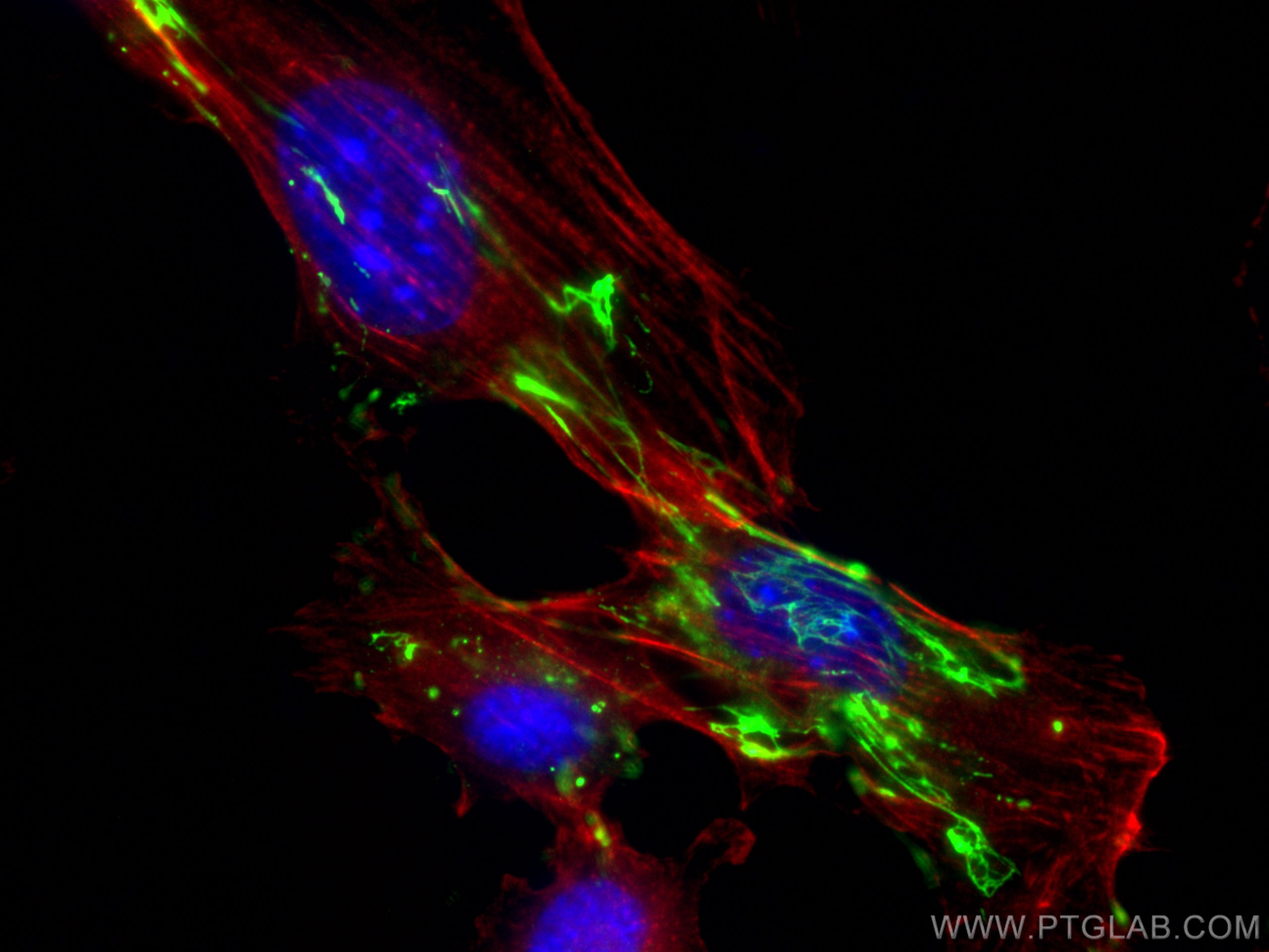 Immunofluorescence (IF) / fluorescent staining of NIH/3T3 cells using Fibronectin Polyclonal antibody (15613-1-AP)