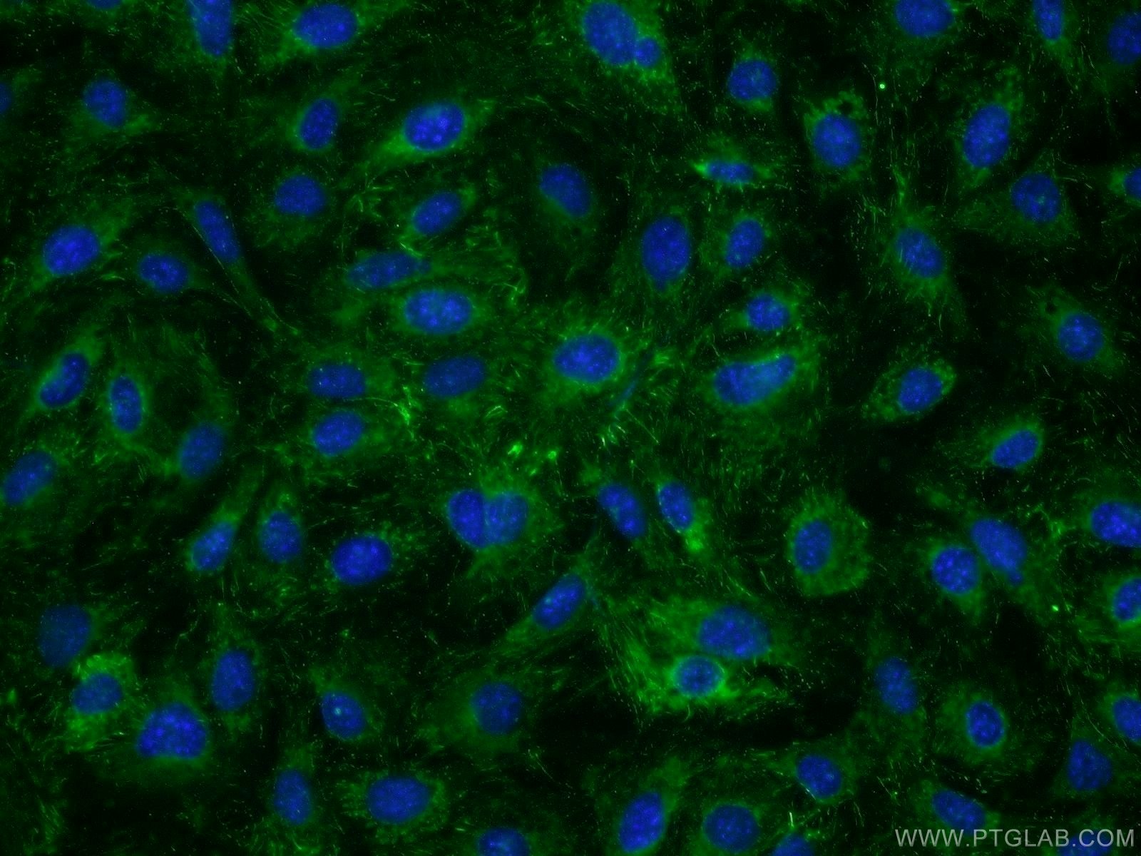 Fibronectin