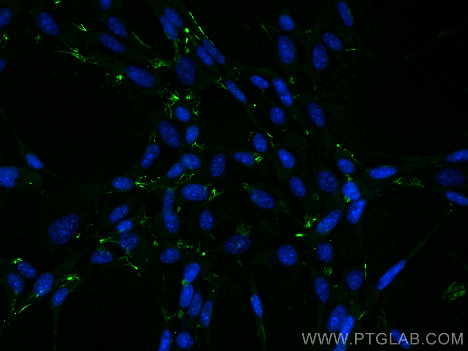 Immunofluorescence (IF) / fluorescent staining of NIH/3T3 cells using Fibronectin Polyclonal antibody (15613-1-AP)