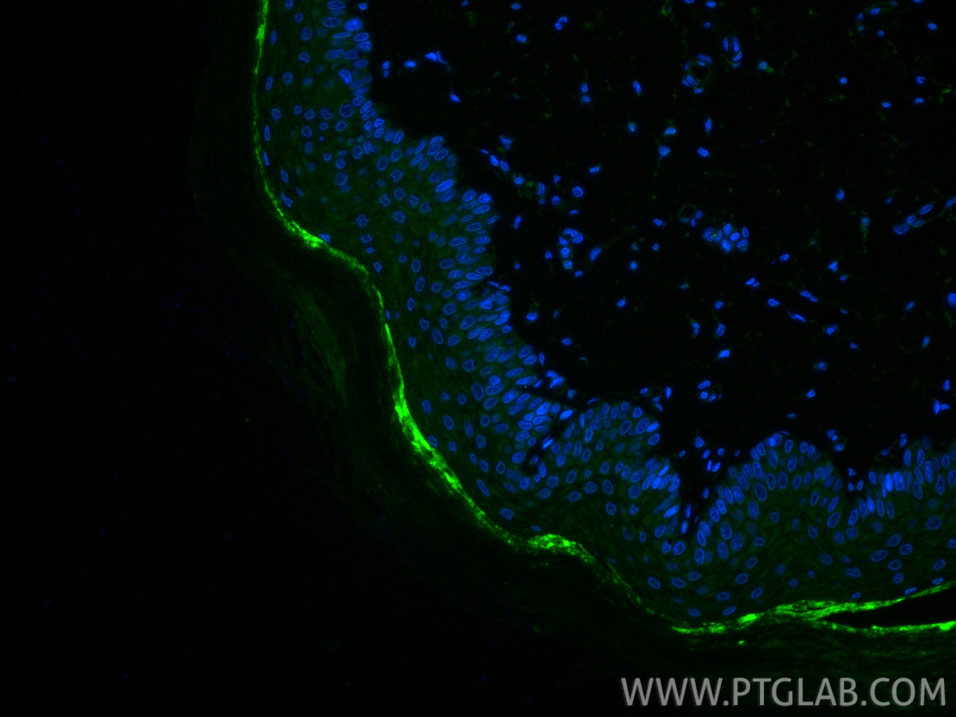 Immunofluorescence (IF) / fluorescent staining of rat skin tissue using Fibronectin Polyclonal antibody (15613-1-AP)