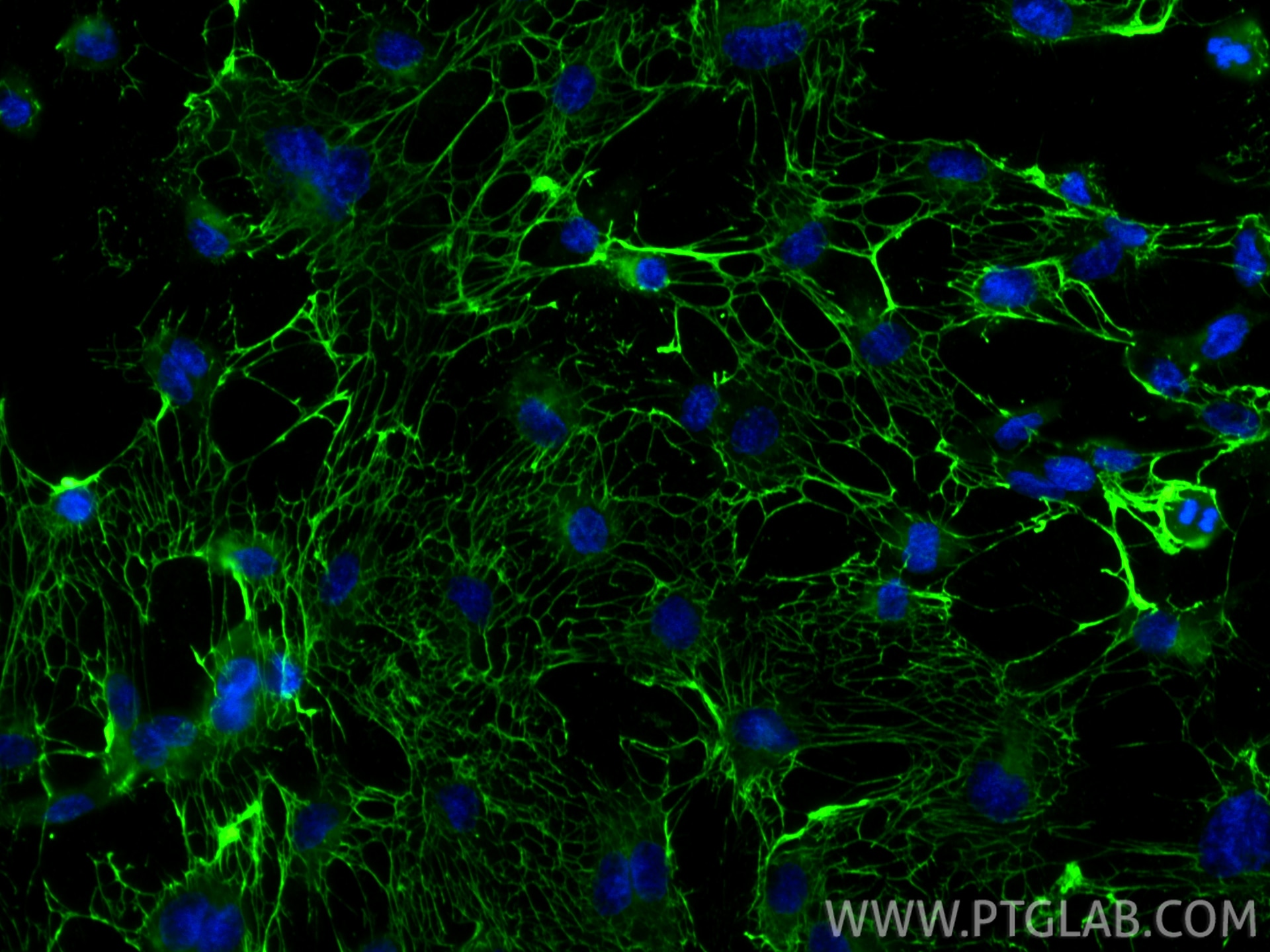 Immunofluorescence (IF) / fluorescent staining of HUVEC cells using Fibronectin Polyclonal antibody (15613-1-AP)