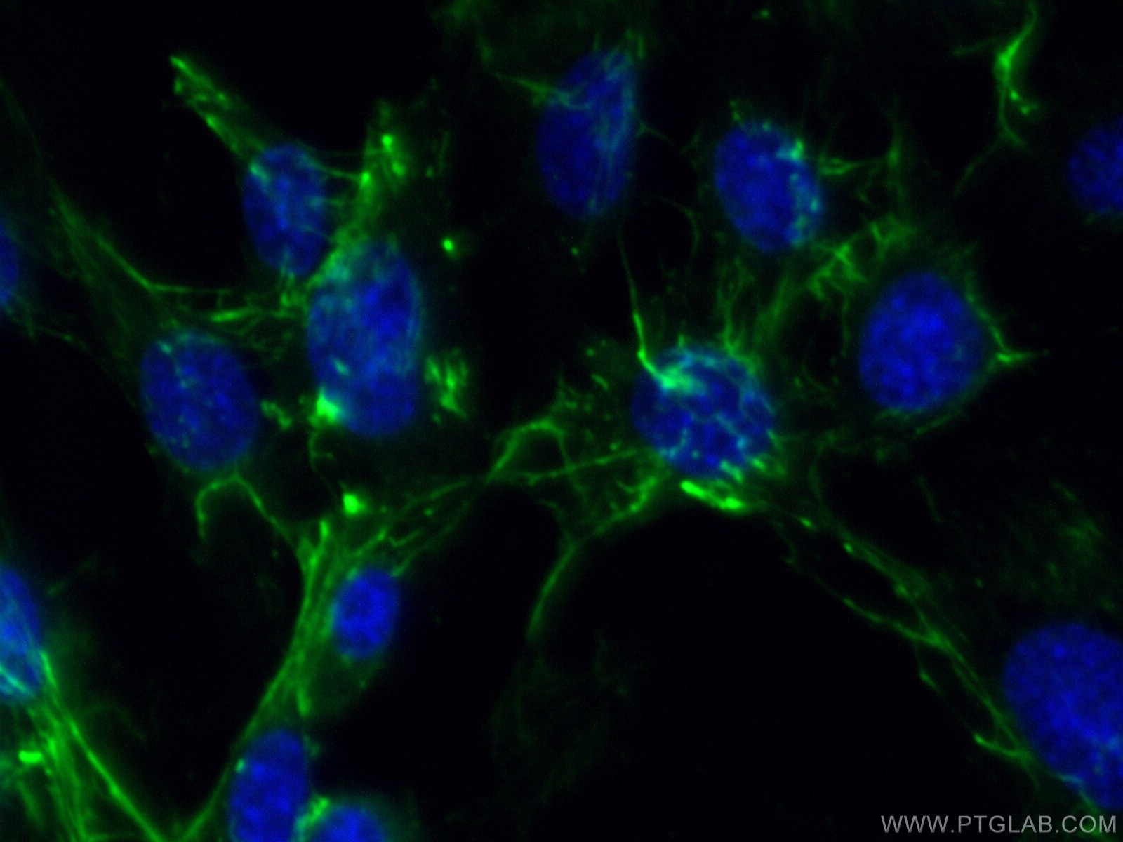 Immunofluorescence (IF) / fluorescent staining of NIH/3T3 cells using Fibronectin Polyclonal antibody (15613-1-AP)