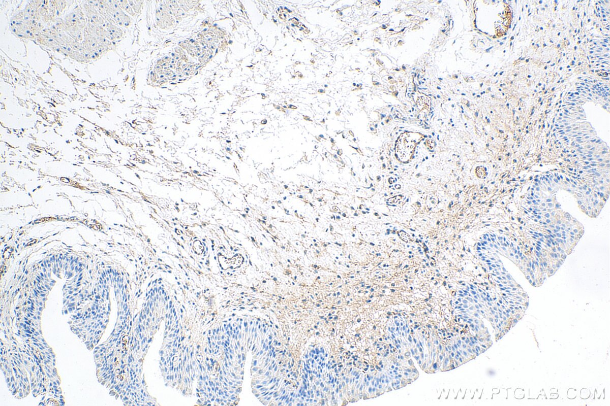 Immunohistochemistry (IHC) staining of rat bladder tissue using Fibronectin Polyclonal antibody (15613-1-AP)