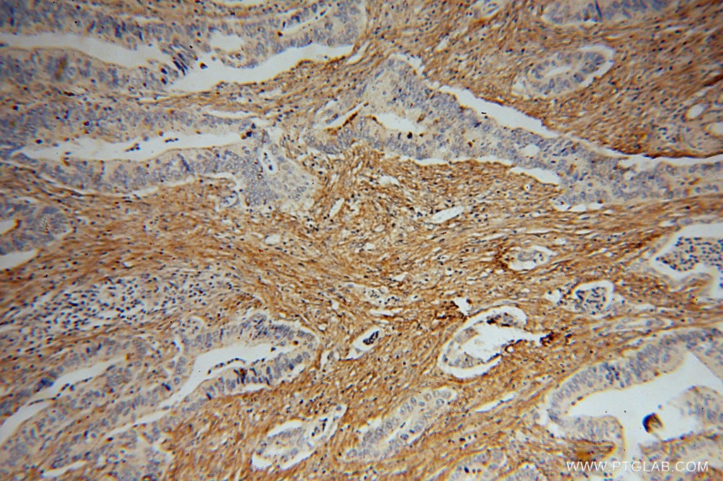 Fibronectin Polyclonal antibody