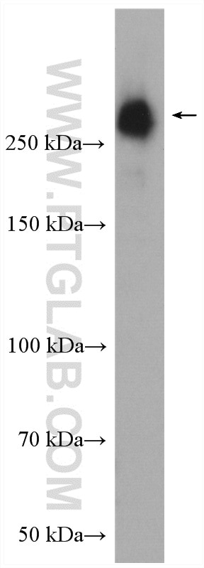 Western Blot (WB) analysis of MDA-MB-453s cells using Fibronectin Polyclonal antibody (15613-1-AP)