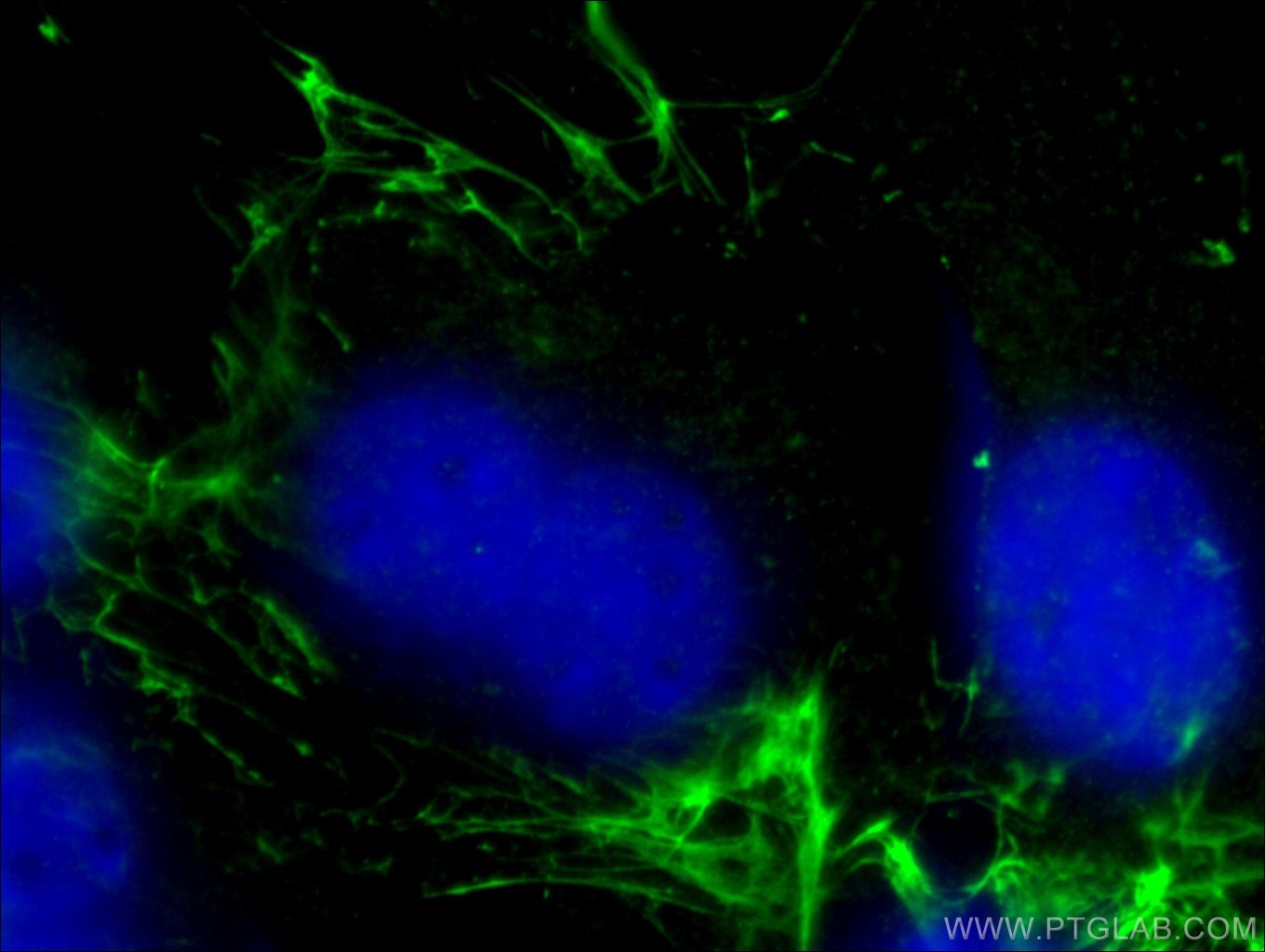 Immunofluorescence (IF) / fluorescent staining of NIH/3T3 cells using Fibronectin Monoclonal antibody (66042-1-Ig)