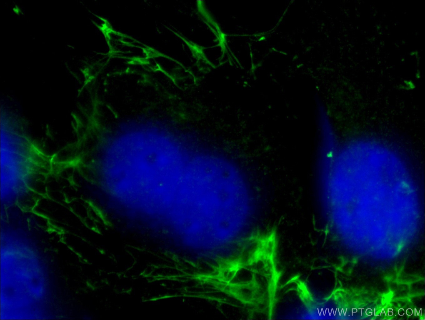 IF Staining of NIH/3T3 using 66042-1-Ig