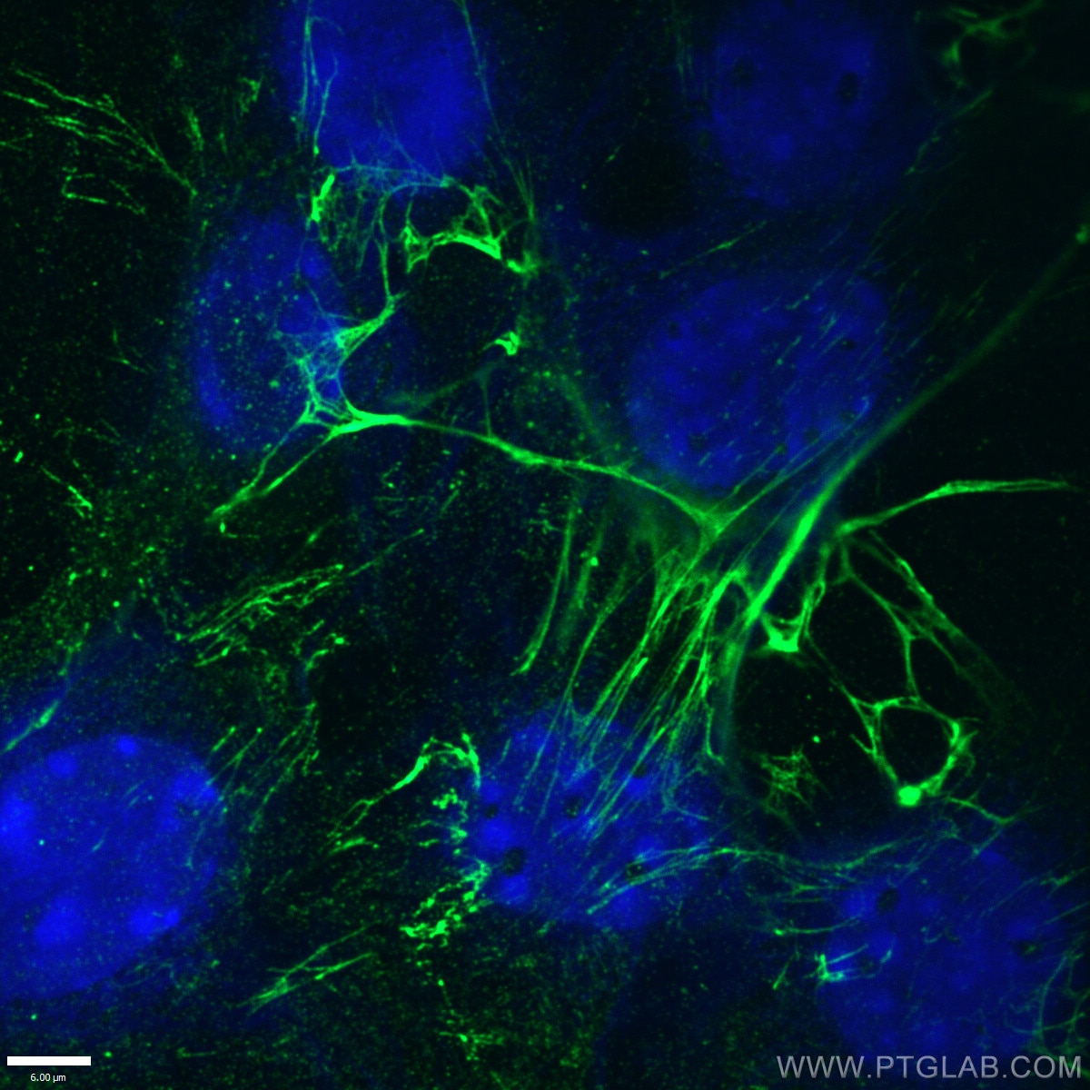 Immunofluorescence (IF) / fluorescent staining of NIH/3T3 cells using Fibronectin Monoclonal antibody (66042-1-Ig)
