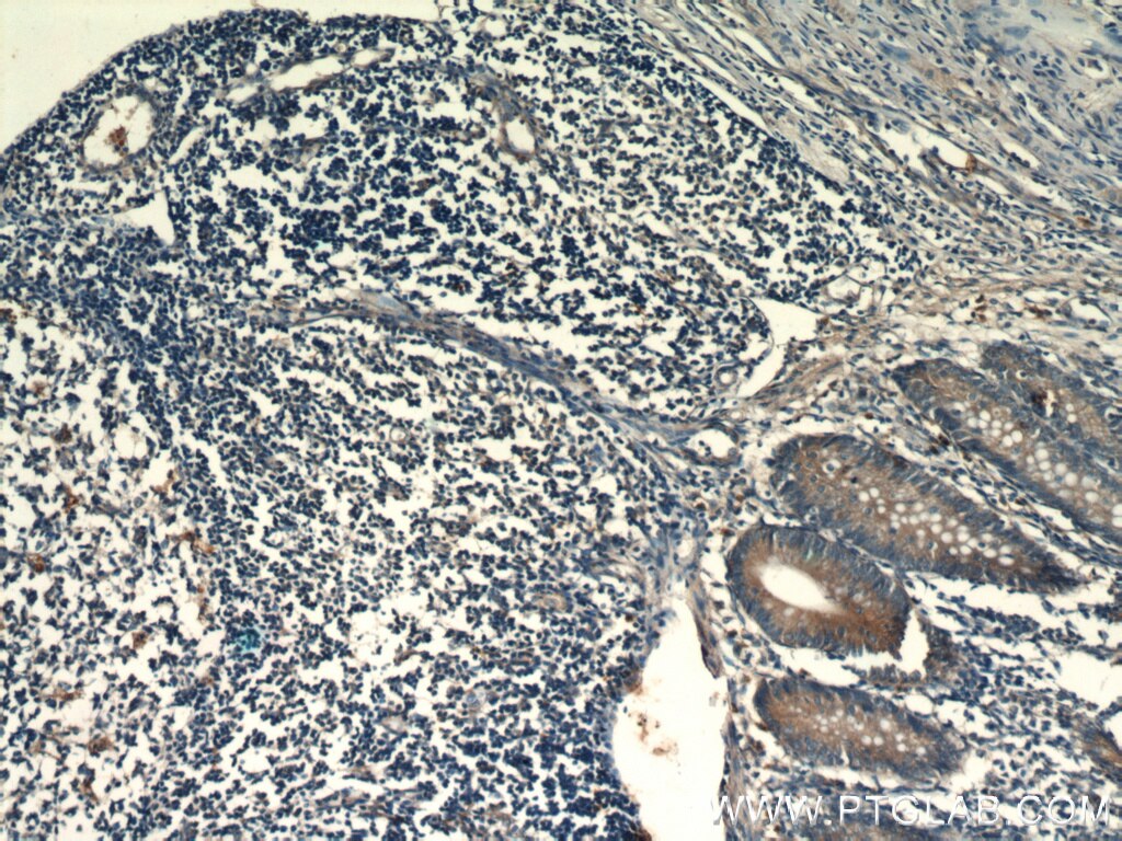 Fibronectin