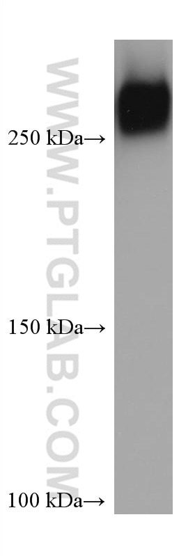 WB analysis of rat serum using 66042-1-Ig