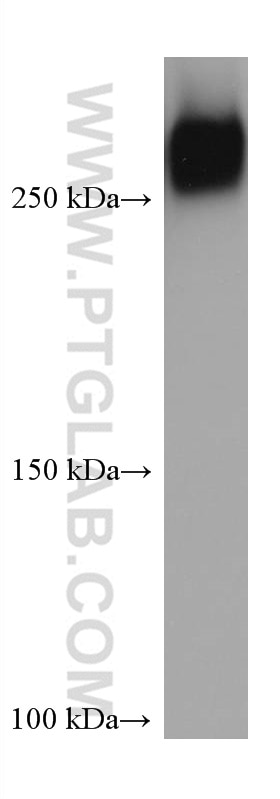 Western Blot (WB) analysis of rat serum using Fibronectin Monoclonal antibody (66042-1-Ig)