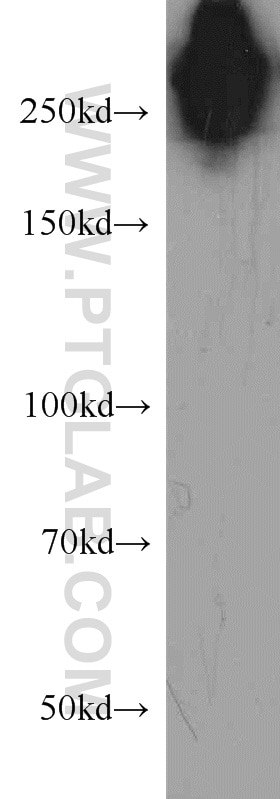 Fibronectin Monoclonal antibody