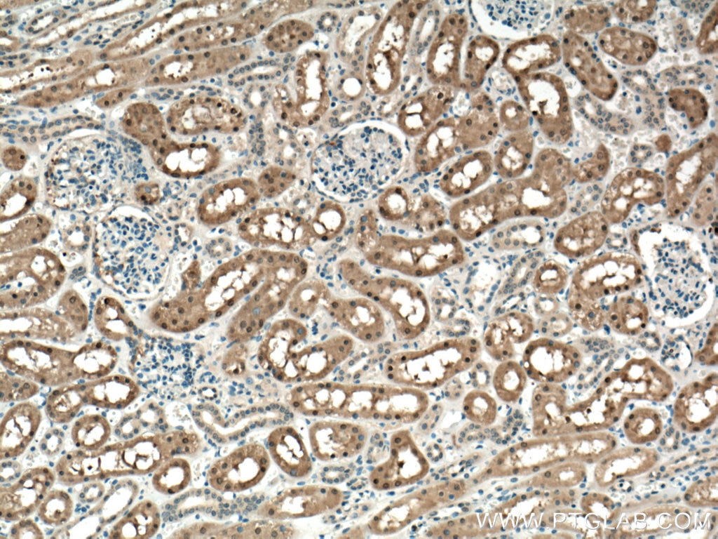Immunohistochemistry (IHC) staining of human kidney tissue using FN3K Polyclonal antibody (14293-1-AP)