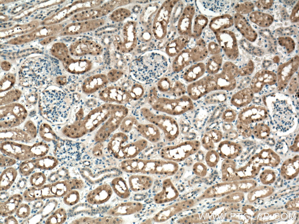 IHC staining of human kidney using 14293-1-AP