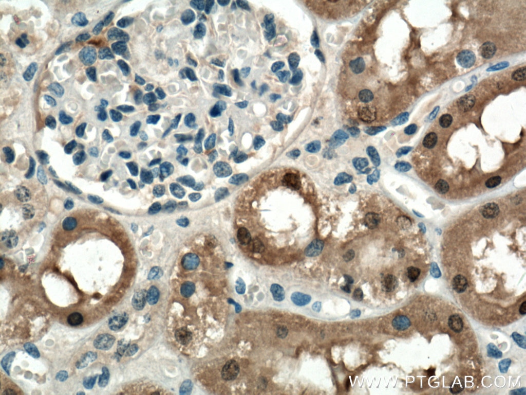 Immunohistochemistry (IHC) staining of human kidney tissue using FN3K Polyclonal antibody (14293-1-AP)