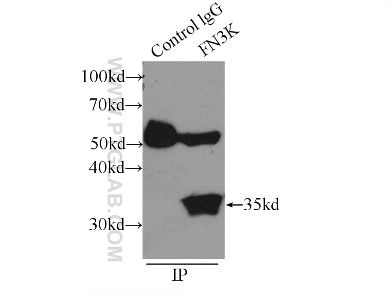 Immunoprecipitation (IP) experiment of HeLa cells using FN3K Polyclonal antibody (14293-1-AP)