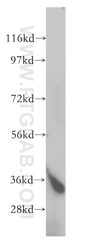 Western Blot (WB) analysis of human kidney tissue using FN3K Polyclonal antibody (14293-1-AP)