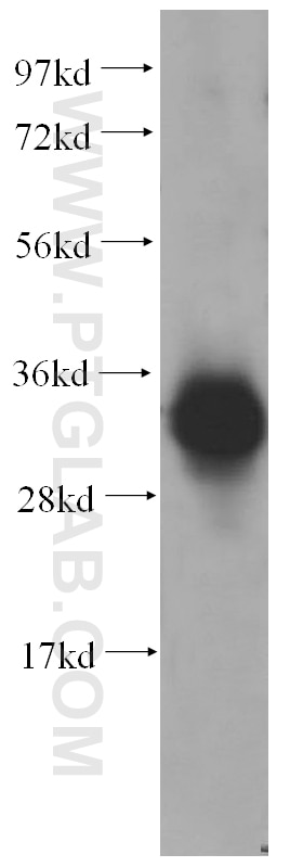 Western Blot (WB) analysis of human heart tissue using FN3K Polyclonal antibody (14293-1-AP)