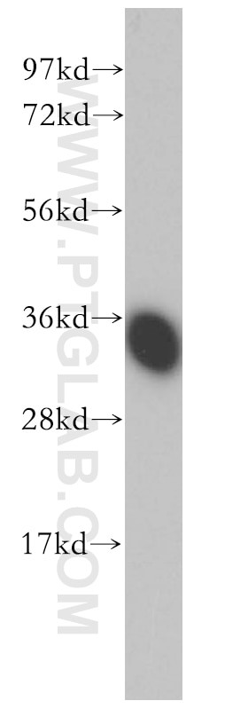 Western Blot (WB) analysis of human brain tissue using FN3K Polyclonal antibody (14293-1-AP)