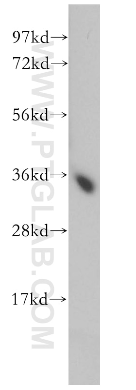 Western Blot (WB) analysis of mouse skeletal muscle tissue using FN3K Polyclonal antibody (14293-1-AP)