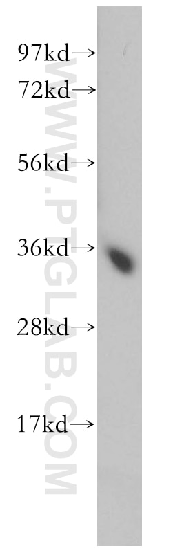 WB analysis of mouse skeletal muscle using 14293-1-AP